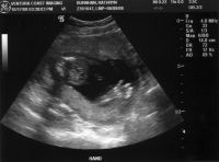 Baby Burnham waves to you in an ultrasound image.